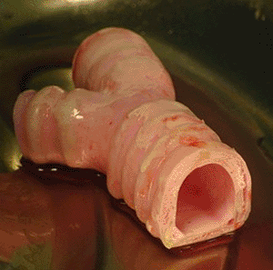 Image: The artificial windpipe created before implantation (Photo courtesy of Harvard Bioscience).